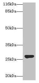 Polyclonal Rabbit anti-Human IZUMO4 Antibody (aa16-214, IHC, WB)