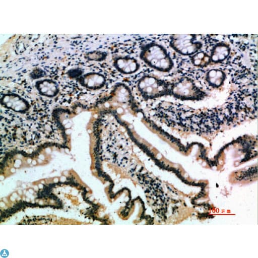 IL17B Antibody