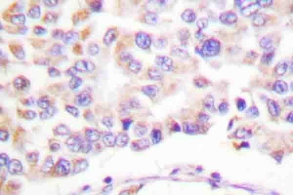 Polyclonal Rabbit anti-Human PLA2G4A Antibody (phospho-Ser505, IHC, WB)
