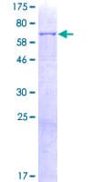 Human PRCP Protein (Recombinant GST)