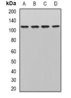 Polyclonal Rabbit anti-Human WDR6 Antibody (WB)