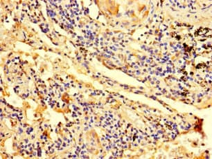 Polyclonal Rabbit anti-Human ZNF559 Antibody
