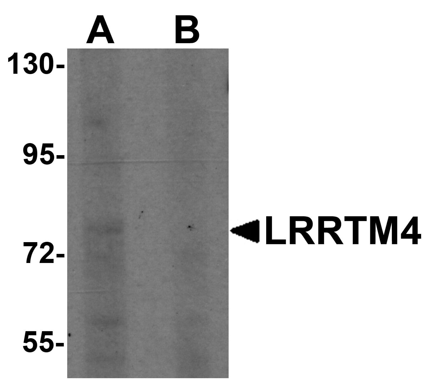 IHC-plus™ Polyclonal Rabbit anti-Human LRRTM4 Antibody (IHC, IF, WB)