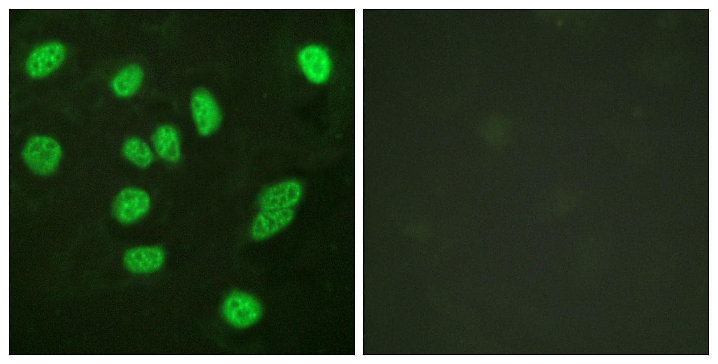 Polyclonal Rabbit anti-Human MYBL2 Antibody (p577/581, IF, WB)