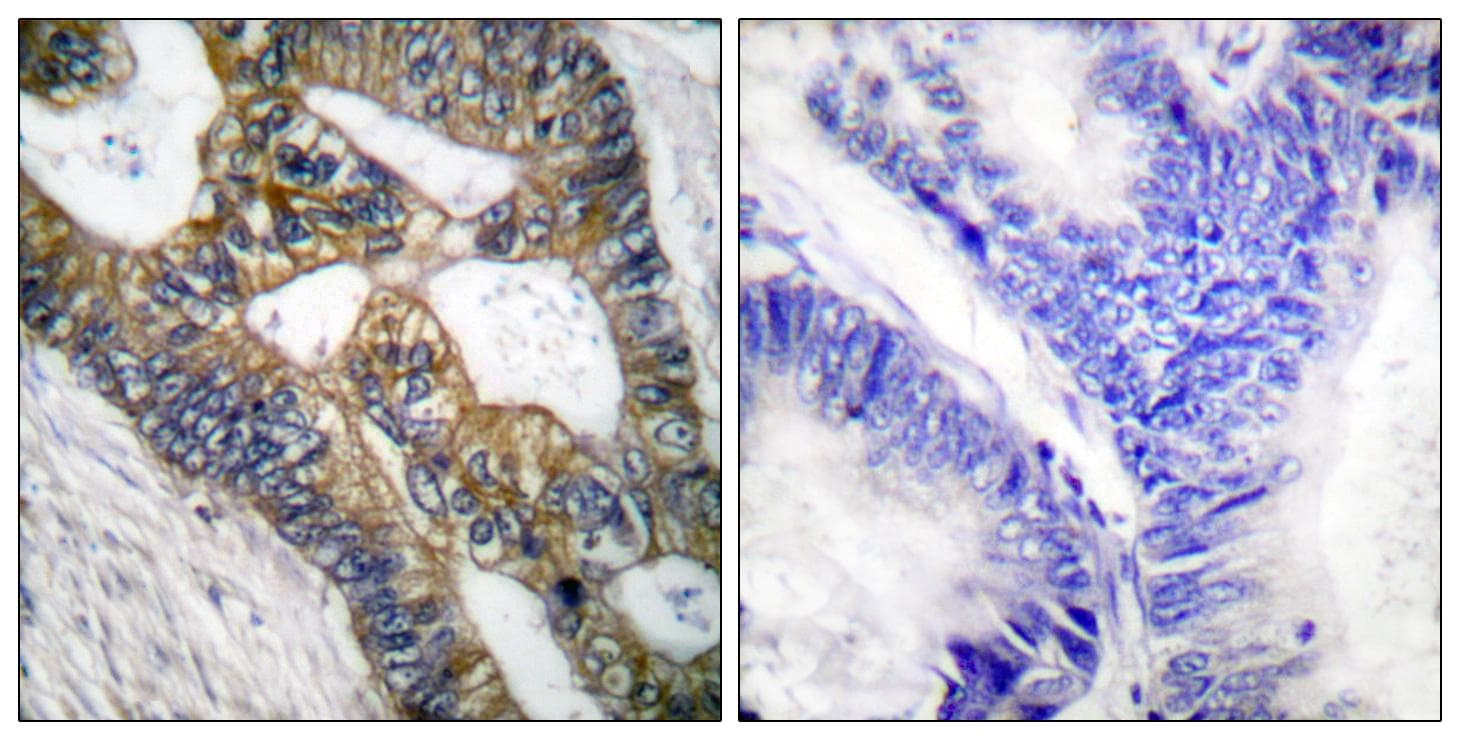 Polyclonal Rabbit anti-Human MMP7 / Matrilysin Antibody (IHC, WB)