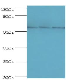 Polyclonal Rabbit anti-Human TXNRD2 Antibody (aa100-310, IHC, WB)