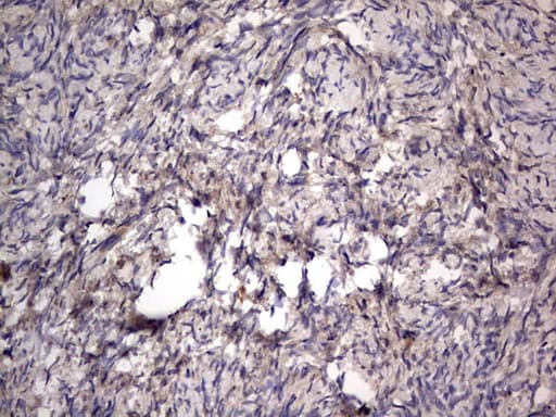 Monoclonal Mouse anti-Human SMPD1 / Acid Sphingomyelinase Antibody (clone OTI3H7, aa62-341, IHC, WB)