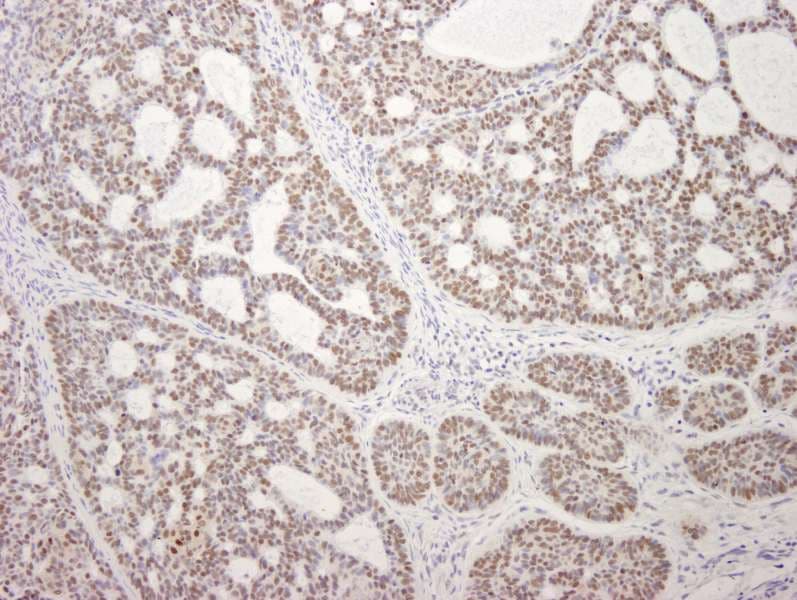 MDC1 Antibody (aa1375-1425)