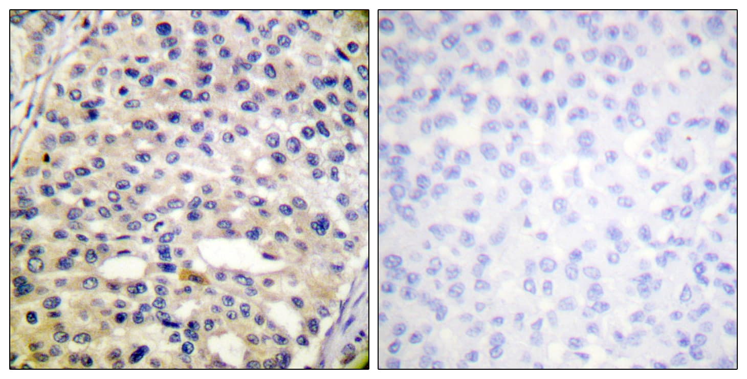 Vimentin Antibody (phospho-Ser56)