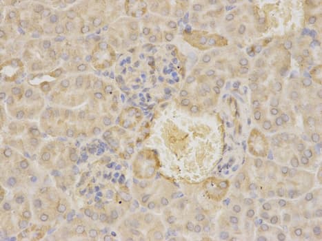 IHC-plus™ Polyclonal Rabbit anti-Human MAOA / Monoamine Oxidase Antibody (IHC, WB)