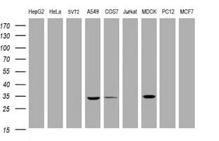 EMA / MUC1 Antibody (clone OTI2E3)