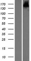 ZBED9 / SCAND3 Protein (Over-Expression Lysate Myc-DDK (Flag))