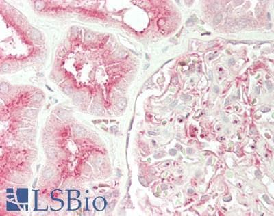 IHC-plus™ UNC13B Antibody (aa1543-1553)