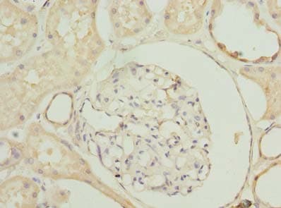 SLA Antibody