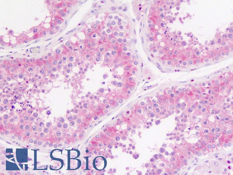 IHC-plus™ Polyclonal Rabbit anti-Human SLC29A1 / ENT1 Antibody (Ser254, IHC, WB)