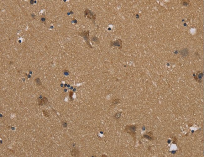 PUS10 Antibody