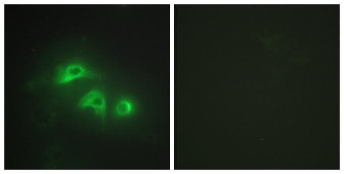 AK1 / Adenylate Kinase 1 Antibody