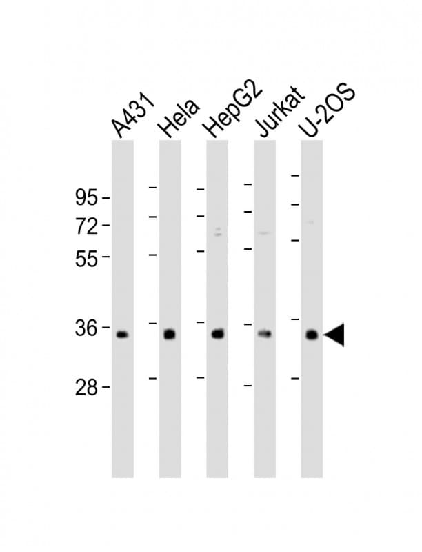 Polyclonal Rabbit anti-Human SR Protein / RNPS1 Antibody (aa11-44, WB)