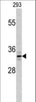 PPT1 / CLN1 Antibody (aa269-300)