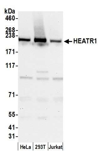 HEATR1 Antibody (aa2094-2144)