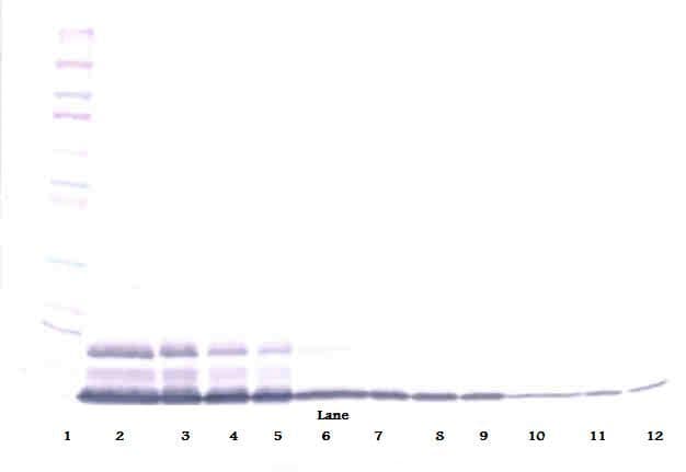 IL8 / Interleukin 8 Antibody