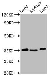 HOXD1 Antibody