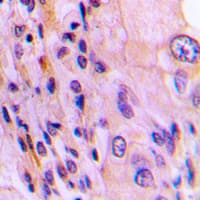 RTKN / Rhotekin Antibody (Internal)