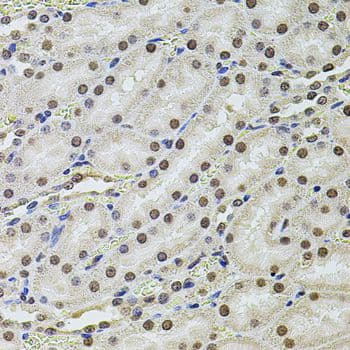 SET / TAF-I Antibody