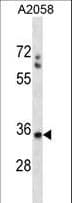 Polyclonal Rabbit anti-Human SPEM1 Antibody (aa115-143, WB)