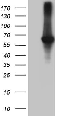 Rhodopsin Kinase / GRK1 Antibody (clone OTI4G8)