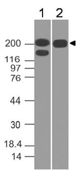 SPTBN2 Antibody