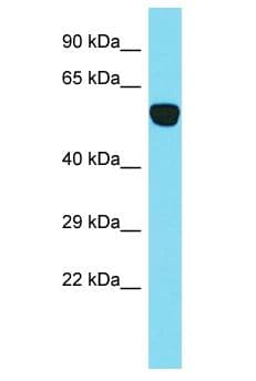 PRKCD / PKC-Delta Antibody (aa10-59)