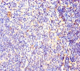 OXCT1 Antibody