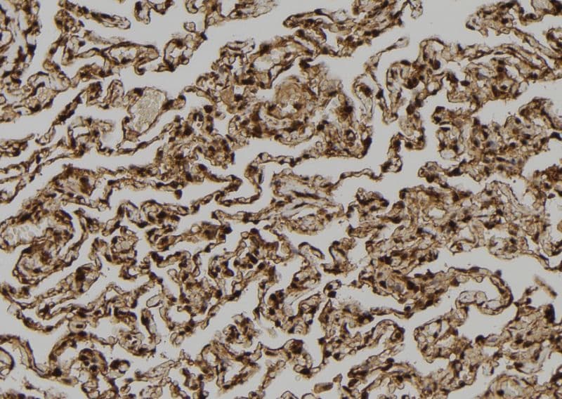 TPI1 / TPI Antibody