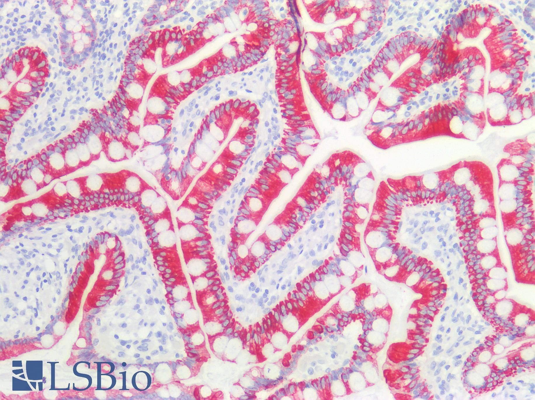 PathPlus™ KRT8 / CK8 / Cytokeratin 8 Antibody