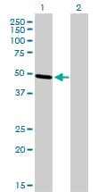TFAP2B / AP2 Beta Antibody (clone 3G5-1D11)