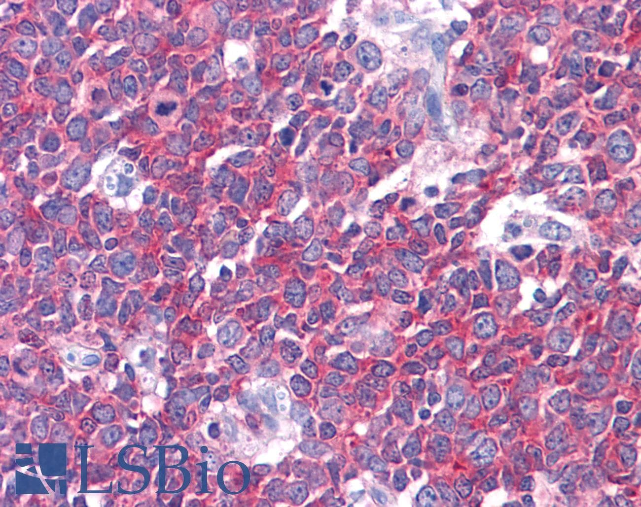 IHC-plus™ KPI-2 / LMTK2 Antibody (clone 3G1)