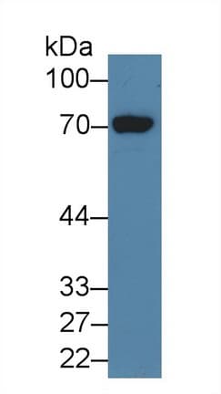 HDC / Histidine Decarboxylase Antibody (aa160-369)