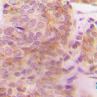 Polyclonal Rabbit anti-Human MAP3K10 / MLK2 Antibody (Internal, IHC, WB)