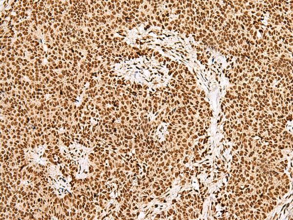 GRSF1 Antibody