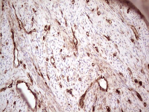 LGALS9 / Galectin 9 Antibody (clone OTI1D12)