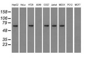 IGF2BP2 Antibody (clone OTI4C4, Carrier-free)