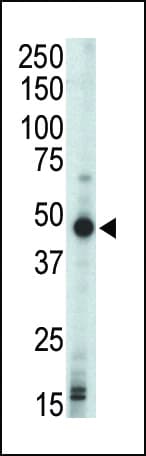 PRKAR1B Antibody (aa50-80)