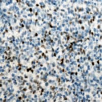 SPI1 / PU.1 Antibody (Internal)