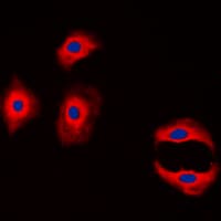 PathPlus™ Polyclonal Rabbit anti-Human CLDN3 / Claudin 3 Antibody (C-Terminus, IHC, IF, WB)