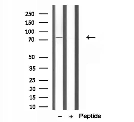 CPT1C Antibody