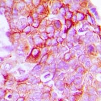 Polyclonal Rabbit anti-Human EPH Receptor B1+B2 Antibody (Internal, IHC, IF, WB)
