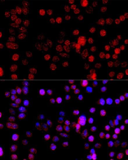 CYP1B1 Antibody
