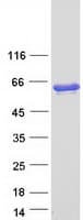 Human GAD65 Protein (Recombinant Myc-DDK (Flag))