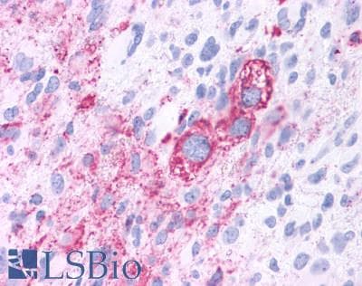 PathPlus™ Polyclonal Rabbit anti-Human RORC / ROR Gamma Antibody (Ligand-binding Domain, IHC)